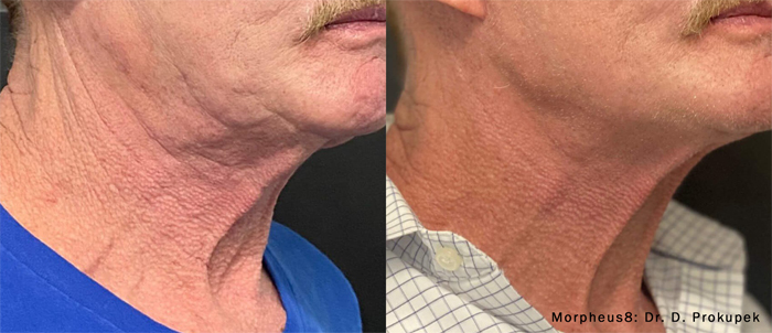 neck